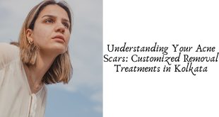 Understanding Your Acne Scars: Customized Removal Treatments in Kolkata